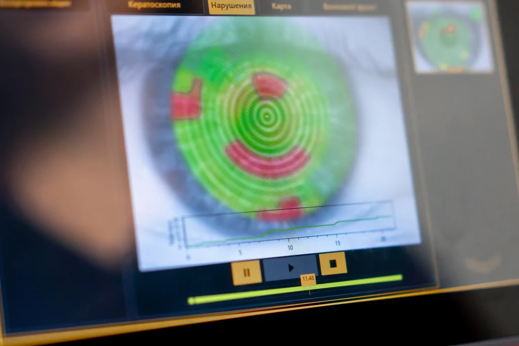 mri ส่วนตา การตรวจ  scan เอ็มอาร์ไอตา MRI