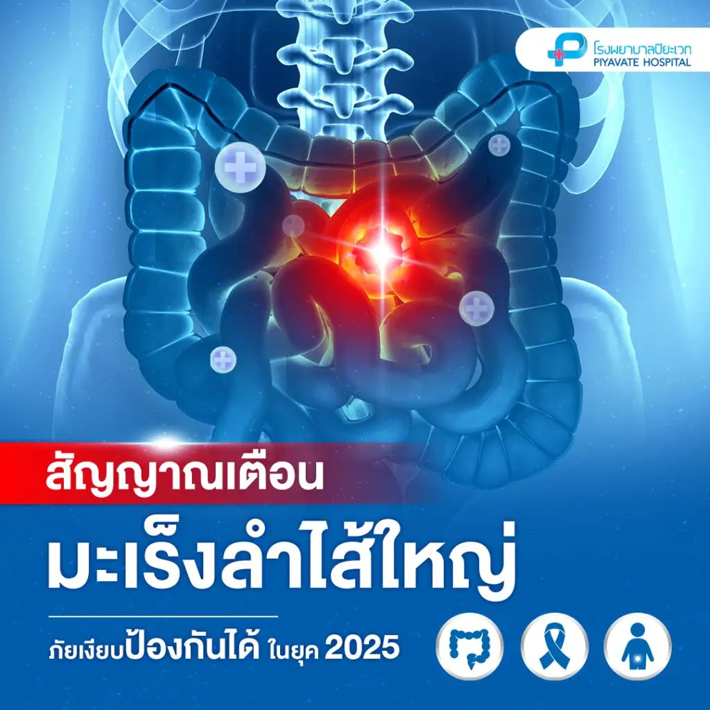 สัญญาณเตือนมะเร็งลำไส้ใหญ่: ภัยเงียบที่ป้องกันได้ในยุค 2025