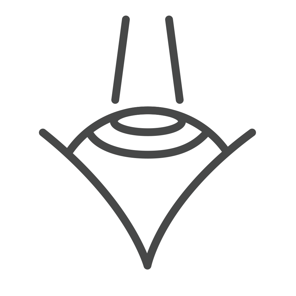 LASIK