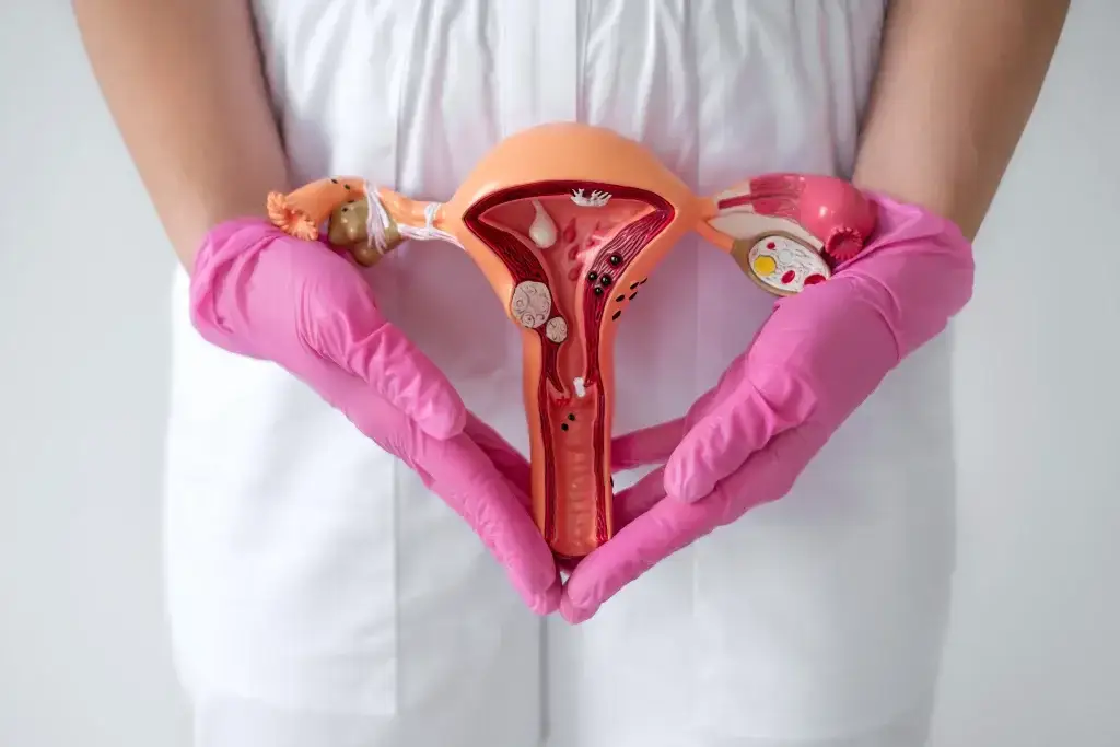 การตรวจ คัดกรองมะเร็งปากมดลูก การรักษา มะเร็งปากมดลูก HPV DNA คืออะไร วัคซีน HPV Pap smear มะเร็งปากมดลูกหายได้ไหม