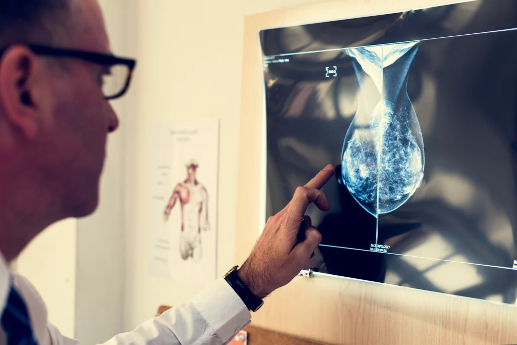 แมมโมแกรม
Mammogram
อัลตราซาวด์เต้านม
Screening
การตรวจแมมโมแกรม
