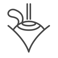 LASIK-Procedures-Femto-LASIK LASIK-Procedures-Femto-LASIK