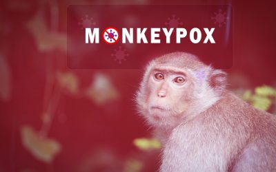 Monkeypox,Outbreak,Concept.,Monkeypox,Is,Caused,By,Monkeypox,Virus.,Monkeypox